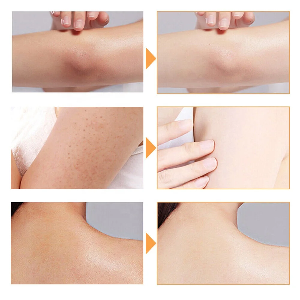 Мыло с морковным цветом лица Отбеливающее средство от прыщей для и тела нежное осветление банное мыло ручной работы