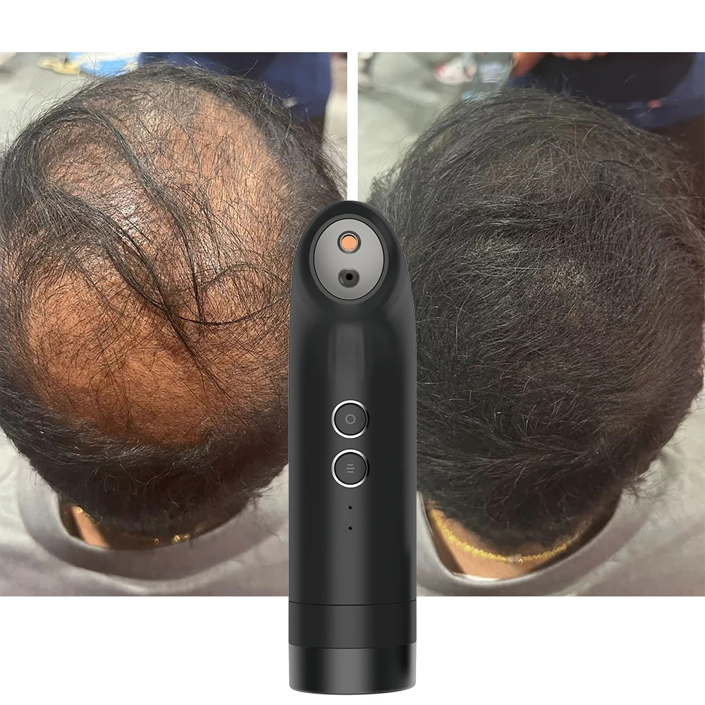 Hot Sale Topik Instant Keratin Hair Building Fibers hair Thickening Powder Fibres 27.5g Electric Hair Fiber Spray Applicator