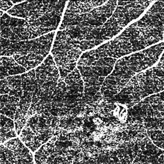 CE marked hospital ophthalmology department Angiogrphy Optical Coherence Tomography
