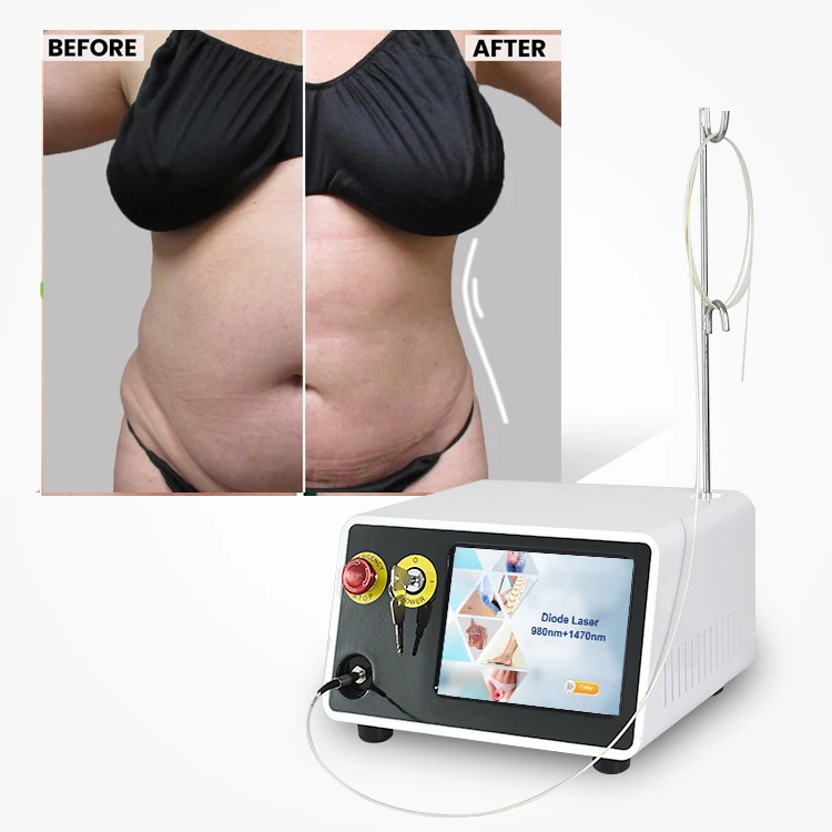 2024 professional endolaser 1470nm fiber laser face lifting 980nm skin tightening facial machine