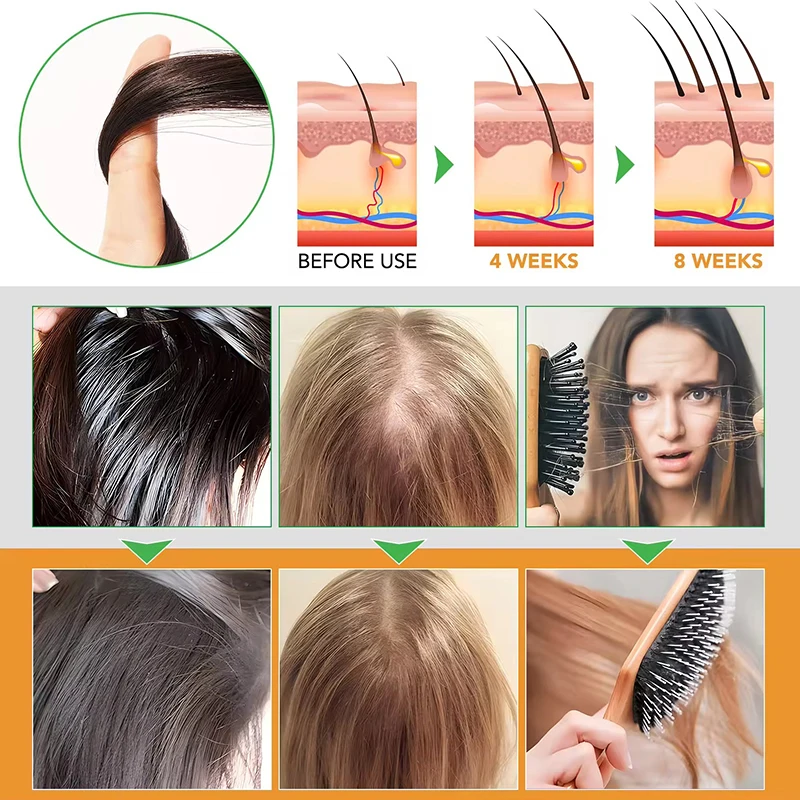 Private Label Natural Moisturizing Anti loss Hair Wash Vegan Hair Growth Biotin Shampoo And Conditioner Kit