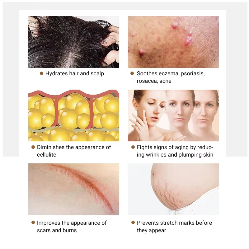 Green Coffee Bean Essential Oil Hair care Natural Skin Care Wrinkle-removing Essential Oil