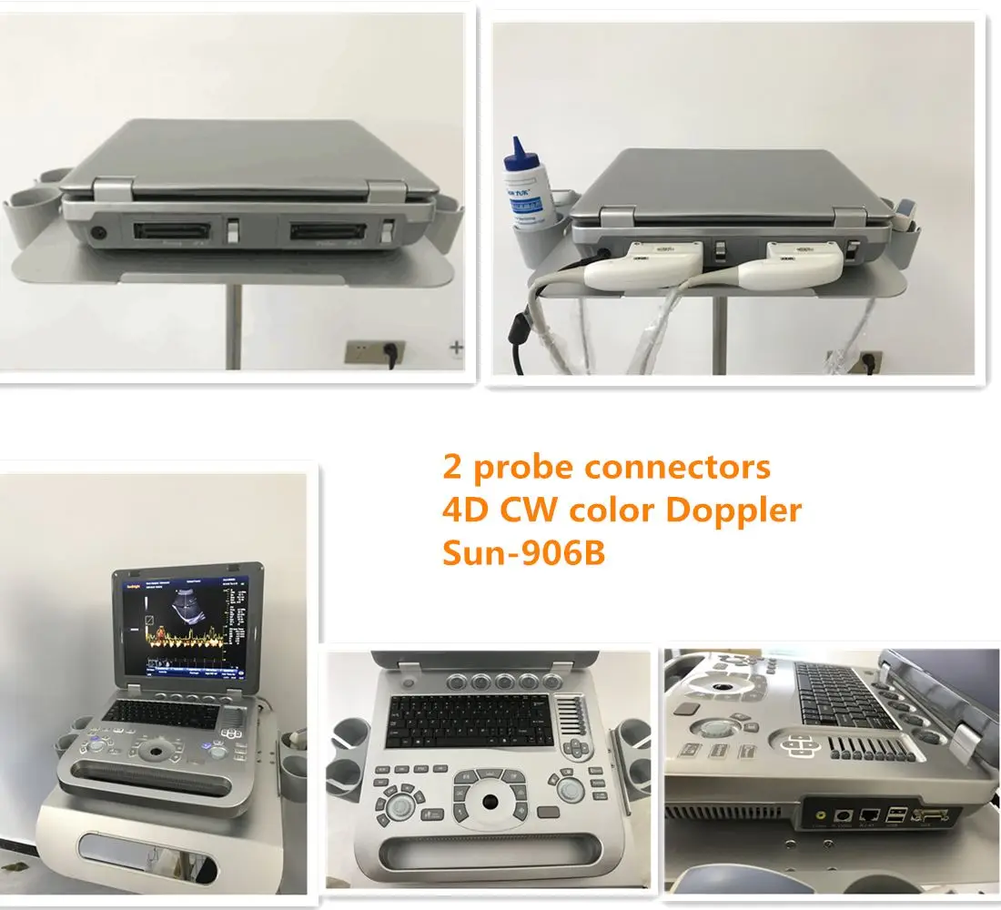Portable Color Doppler Ultrasound Machine Price Medical Echocardiography with Phased Array Probe