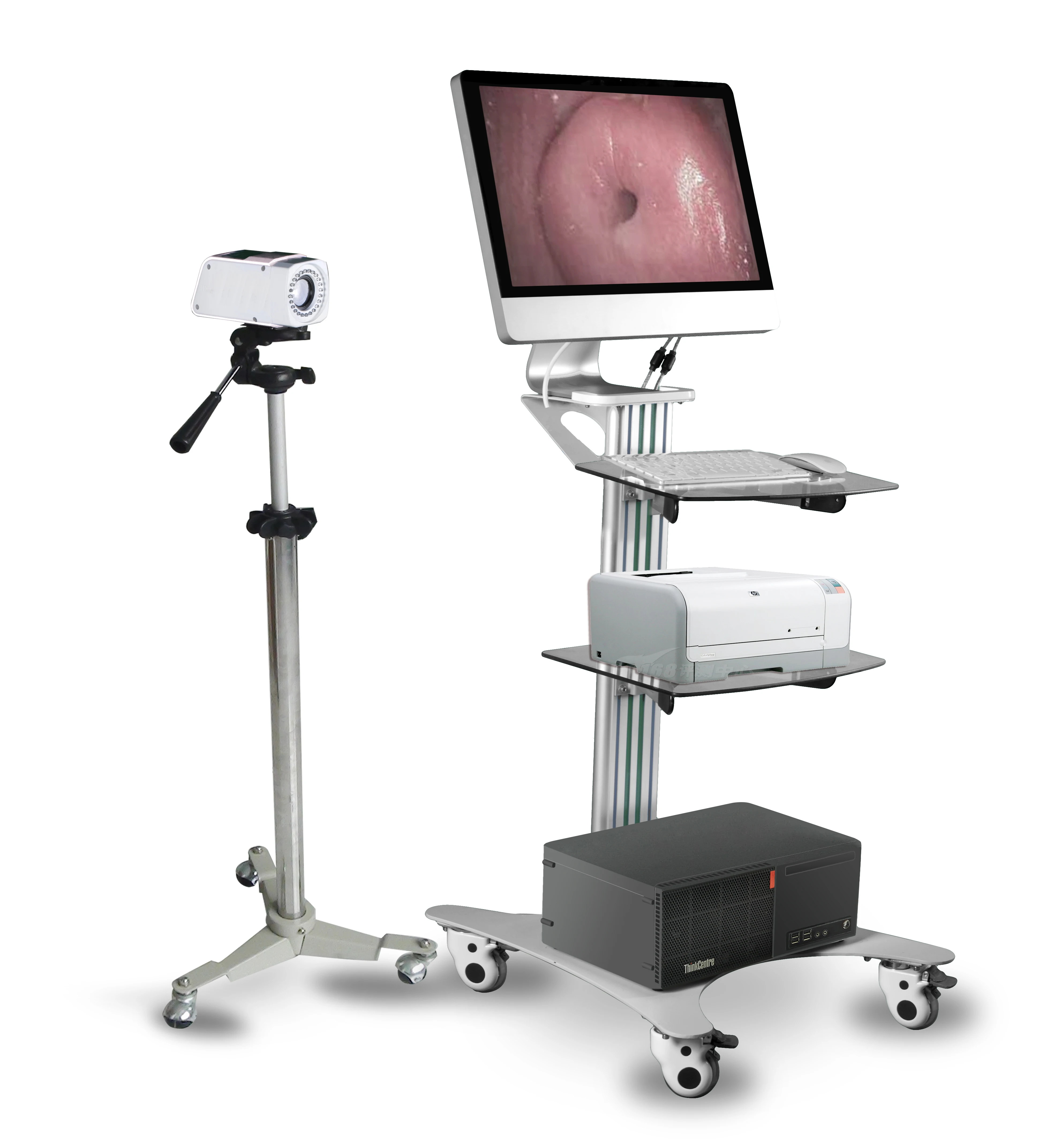 Digital Video Colposcope with good quality and best price,Medical machine for colposcopy