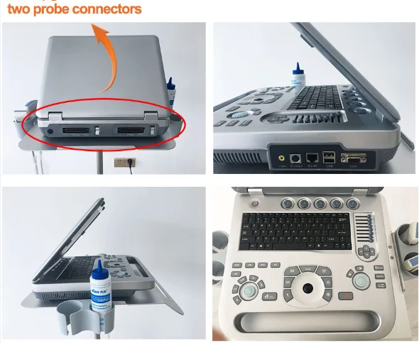 JM-906B laptop ultrasonic machine cheap 3D 4D Color Doppler scanner with battery