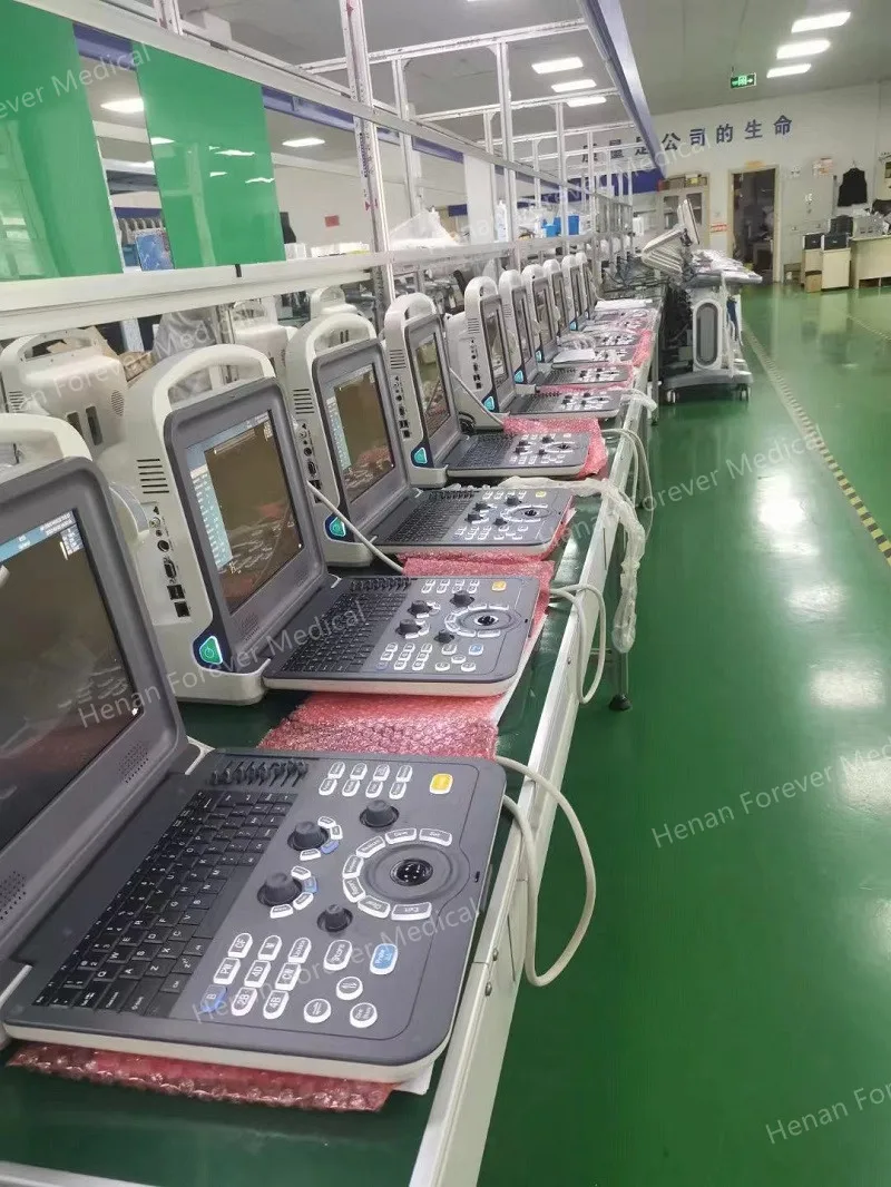 4D Full Digital Color Doppler Ultrasound Diagnostic System Competitive Price 6 Languages Portable Ultrasound