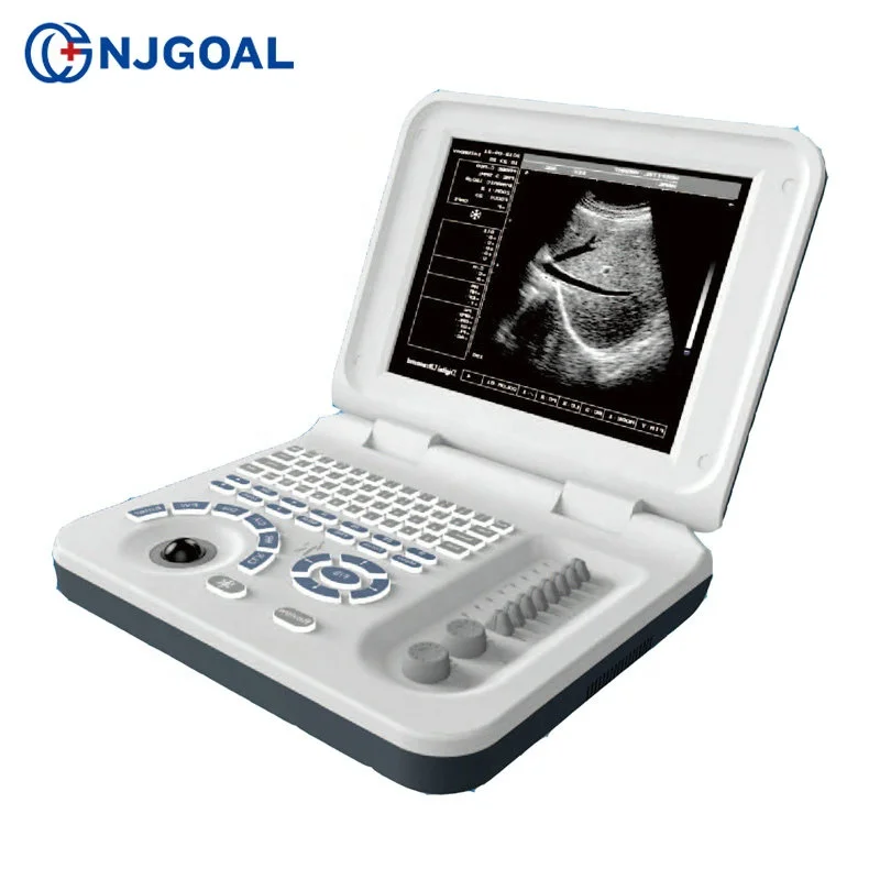 Новый продукт запуск в Китае беременность недели измерения полный цифровой 3d ультразвуковая машина цена