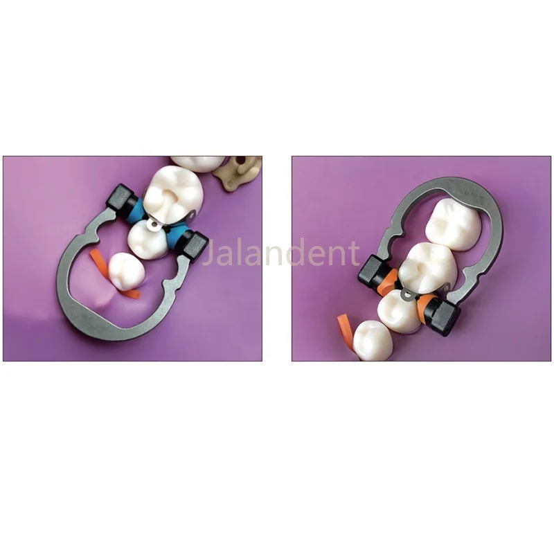 NEW TYPE Dental Tools Autoclavable Matrix Clip Dental NITI Clamps Separating Ring