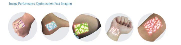 Измеритель прожилки