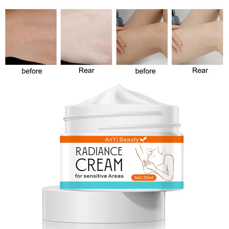 AnYi Beauty RADIANCE CREAM for sensitive Areas Net 30ml Moisturizing White Lifting and firming Skin care face  cream