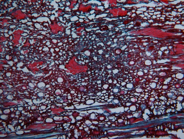 BestScope BS-2042T, классический лабораторный коллаж Infinity Koehler, студенческий тринокулярный биологический микроскоп