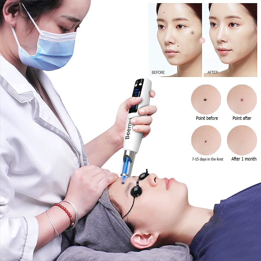 High Quality Red Blue Light Mini Handheld Neatcell Picosecond Laser  Portable Laser Picosecond Pen Home Use Mole Tattoo Removal