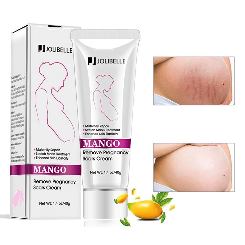 Частная этикетка растяжек шрамов крем для удаления беременности шрамы беременности и родам ремонт растяжек крем для лечения акне