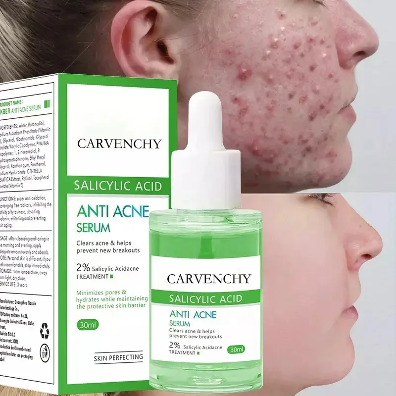 Acne Breaking Serum Anti Acne Salicylic Acid Acne Scar Removal Treatment Skin Care Face Serum