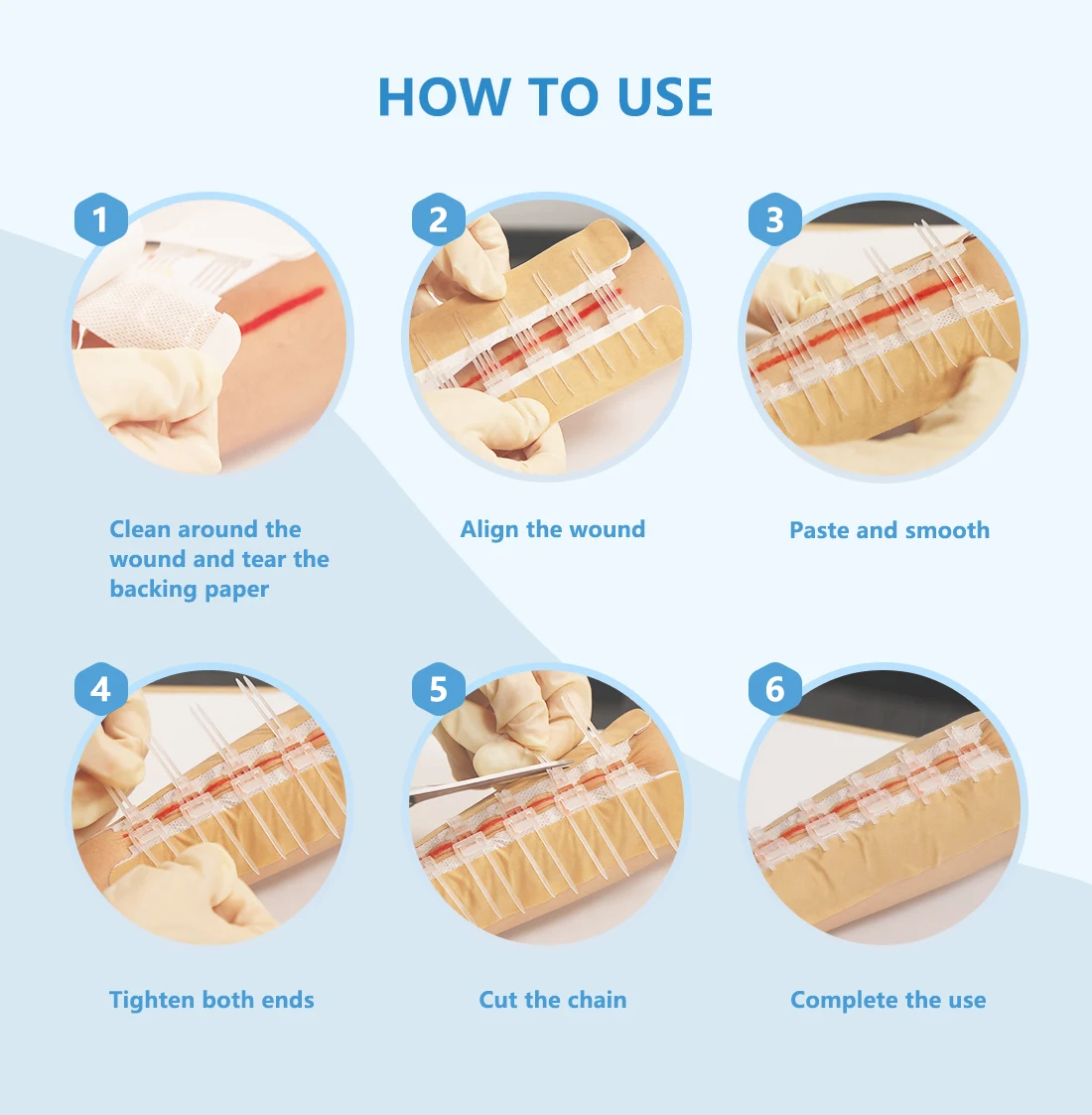 BLUENJOY Sterile Skin Color Wound Closure Device First Aid Wound Care Zip Stitch Wound Device