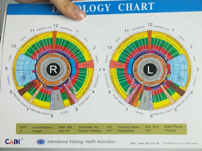 English spanish korean russian 12MP health analysis iris iriscope iridology camera with auto software