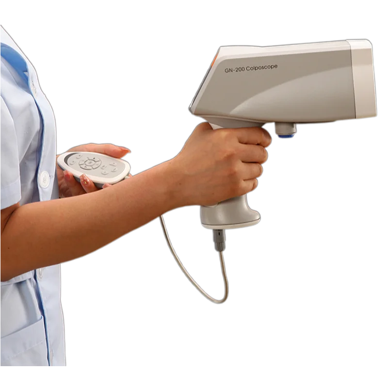 Colposcope Video KN-2200 Digital Colposcope Vaginal Camera for Gynecology