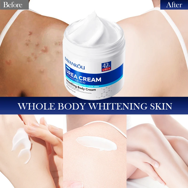 OEM FAYANKOU Wholesale Urea Salicylic acid Smoothing Body Whitening Cream Korean Skin Care Brightening Skin Tone  Body Lotion