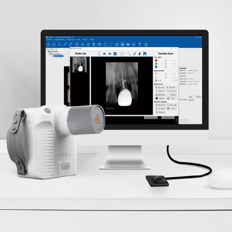Oem Custom X-Ray Machine Prices Digital X Ray Machine Digital X Ray Device