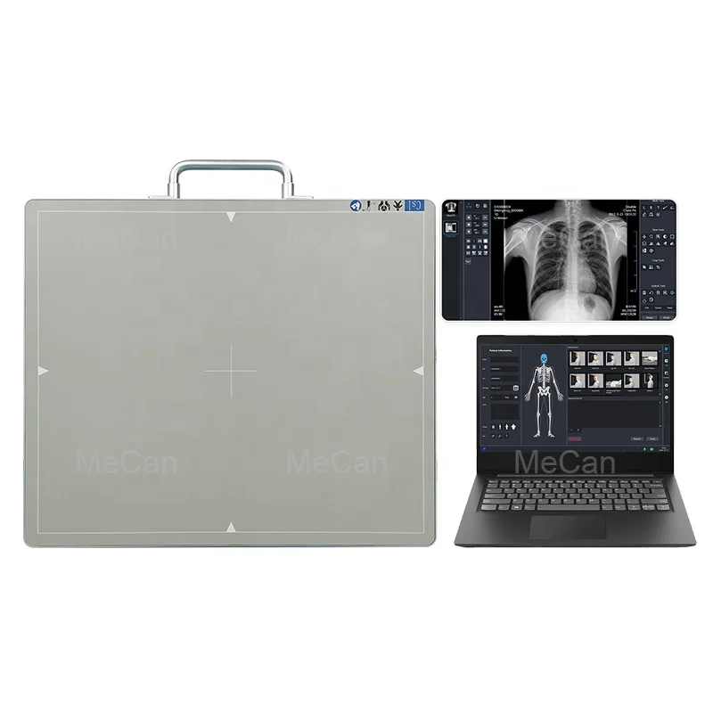 17*17 Dr Medical Veterinary Wireless Digital X-Ray Flat Panel Detector With Outstanding Image