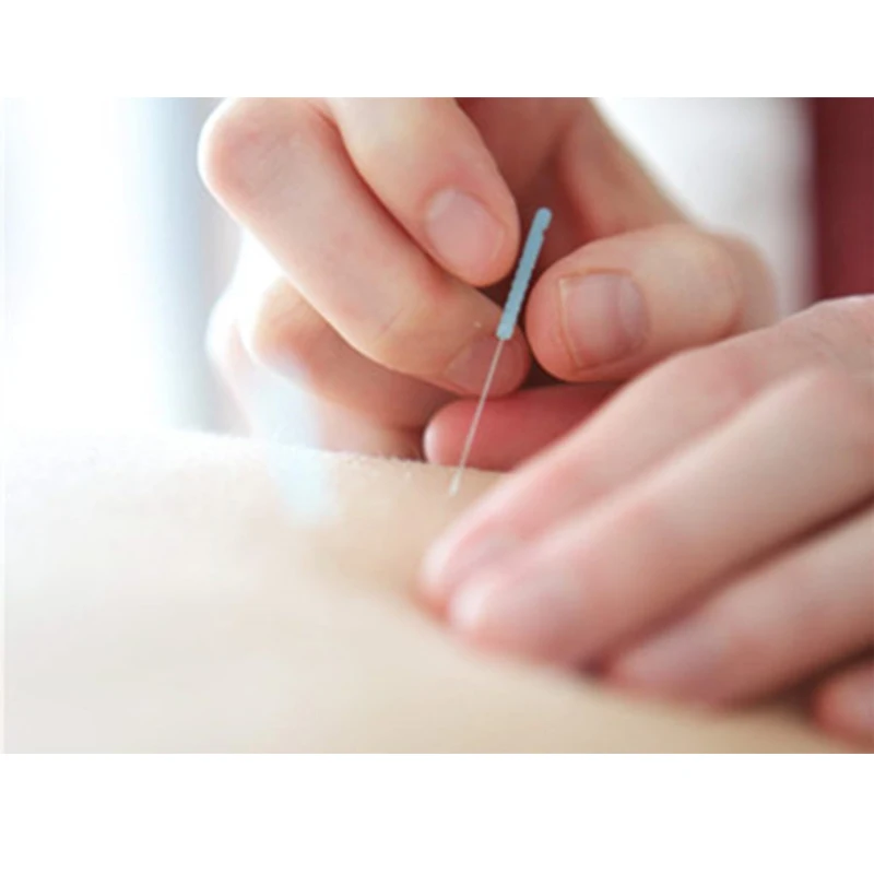 High Quality Hand Acupuncture Needles Sujok Needles