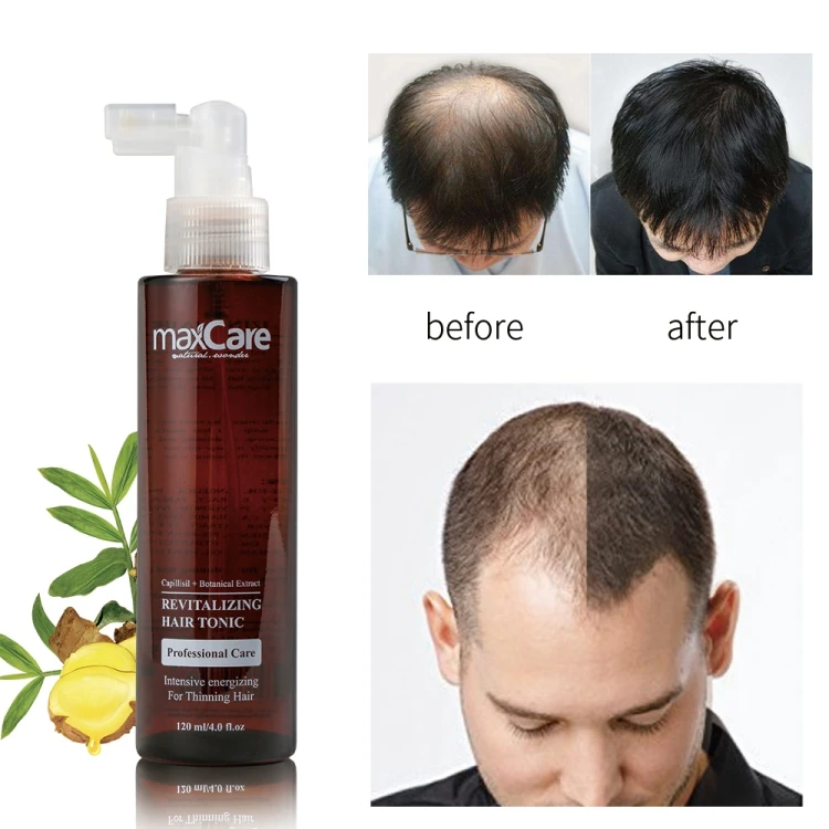 High-quality maxcare ginger hair tonic anti hair loss for hair grwoth