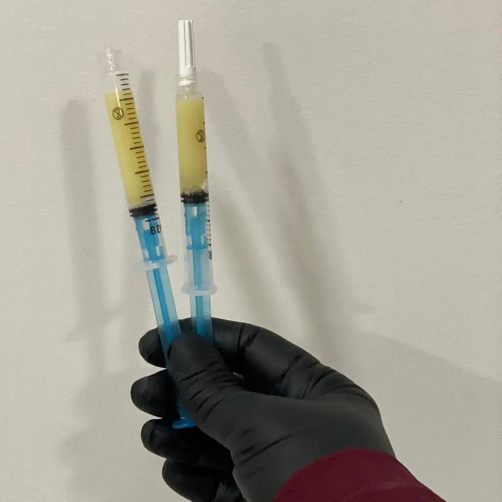 Cooling Heating PRP PPP PRF Bio Filler Making Machine Plasma Gel Biofiller