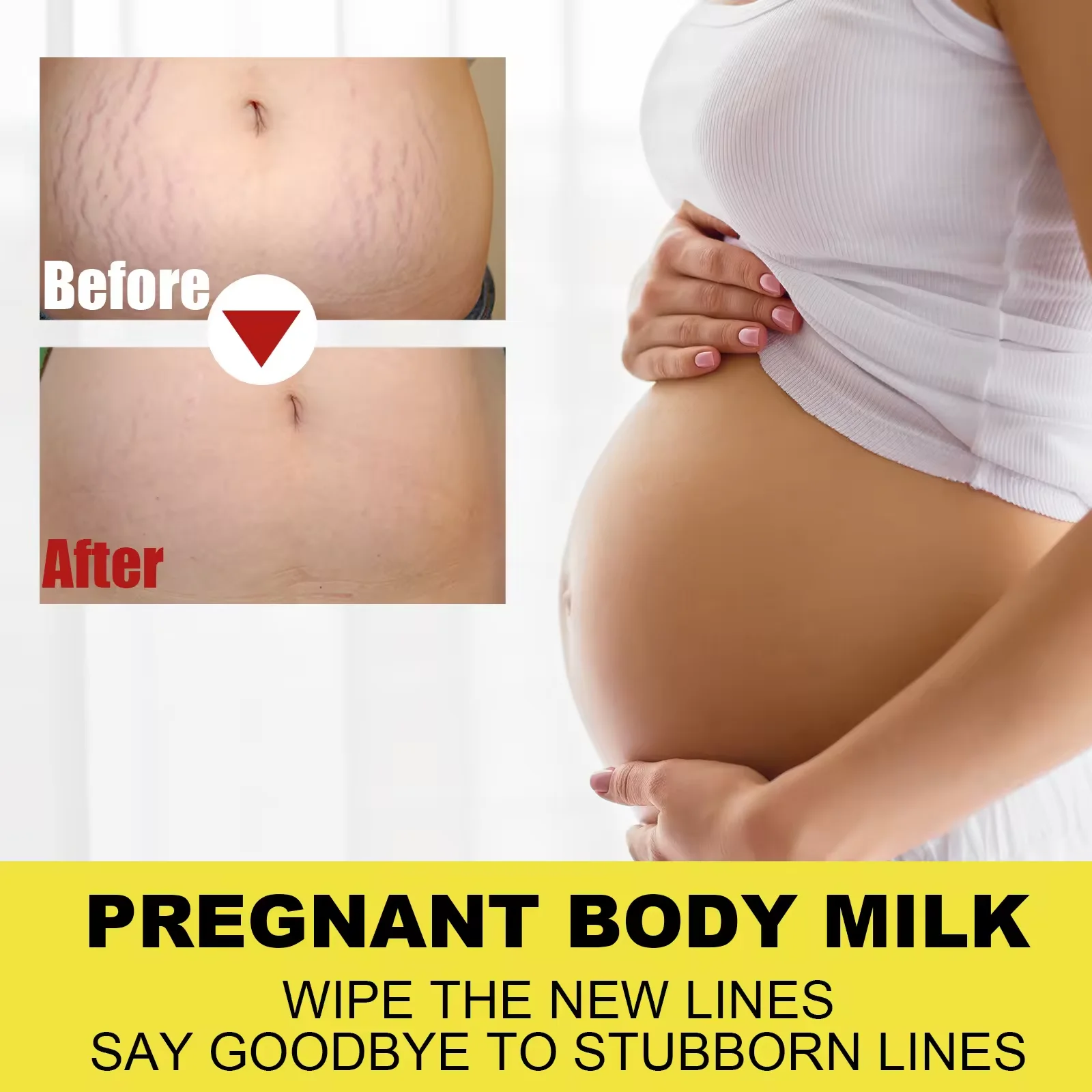 Improve Skin Relaxation Improve Skin Relaxation Stretch Marks Scar Removal Cream After Pregnancy Anti Stretch Mark Cream