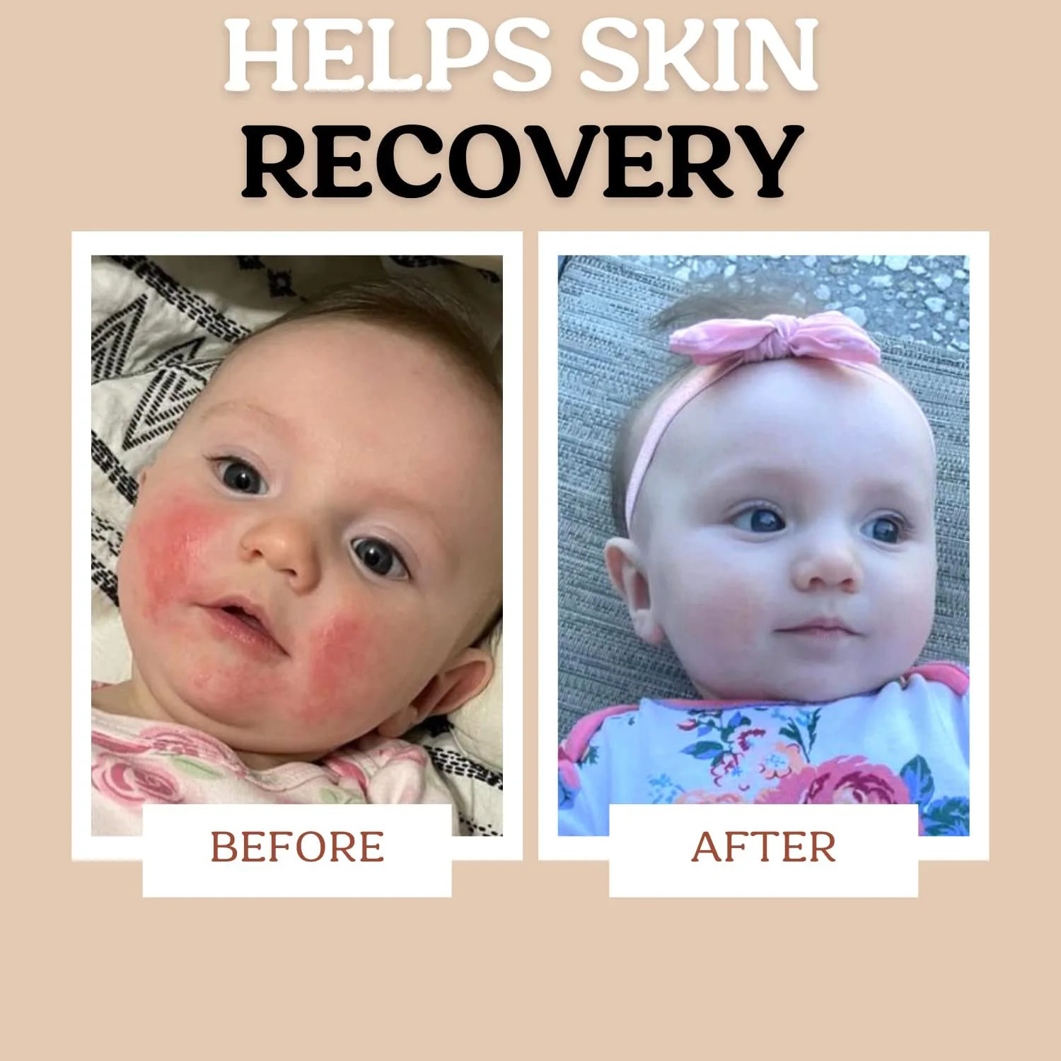 Baby Body Face Biome Barrier Cream Lotion Ointment Hydrating Soothing Clean Ingredients All Over Protection Safe for All Skin