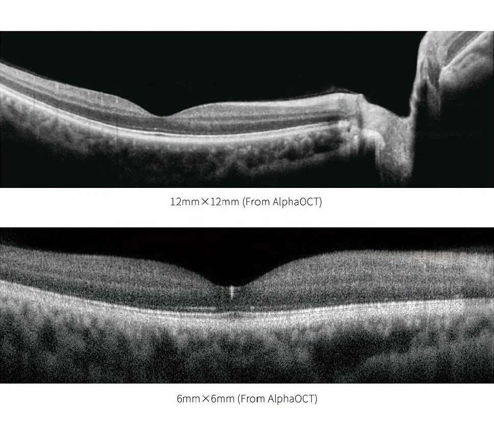 CE marked medical ophthalmology department Optical Coherence Tomography angiogrphy