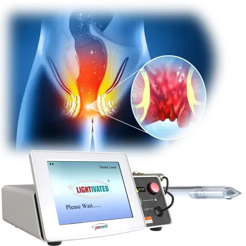 Best Sell 980nm 1470nm Diode Laser Machine Proctology Anal Piles Surgery Aesthetic Fistula Hemorrhoid Urology Doctor Surgeon Use