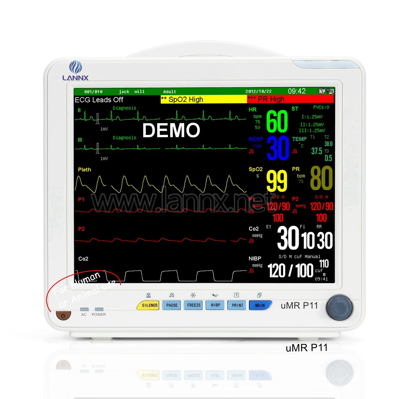 LANNX uMR P11 CE approved portable battery 6 parameter human or animal use Bedside monitor clinical medical cardiac Monitoring