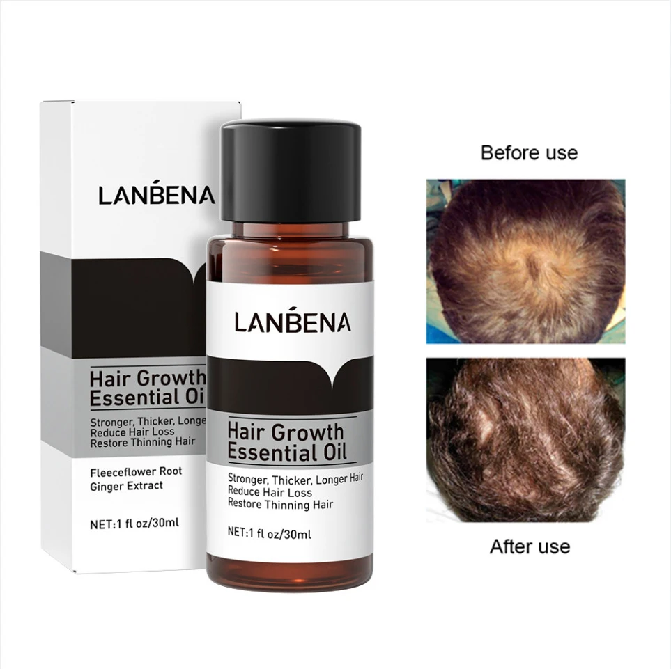 LANBENA Fast Powerful Hair Growth Products Oil Preventing Hair Loss Hair Care Andrea