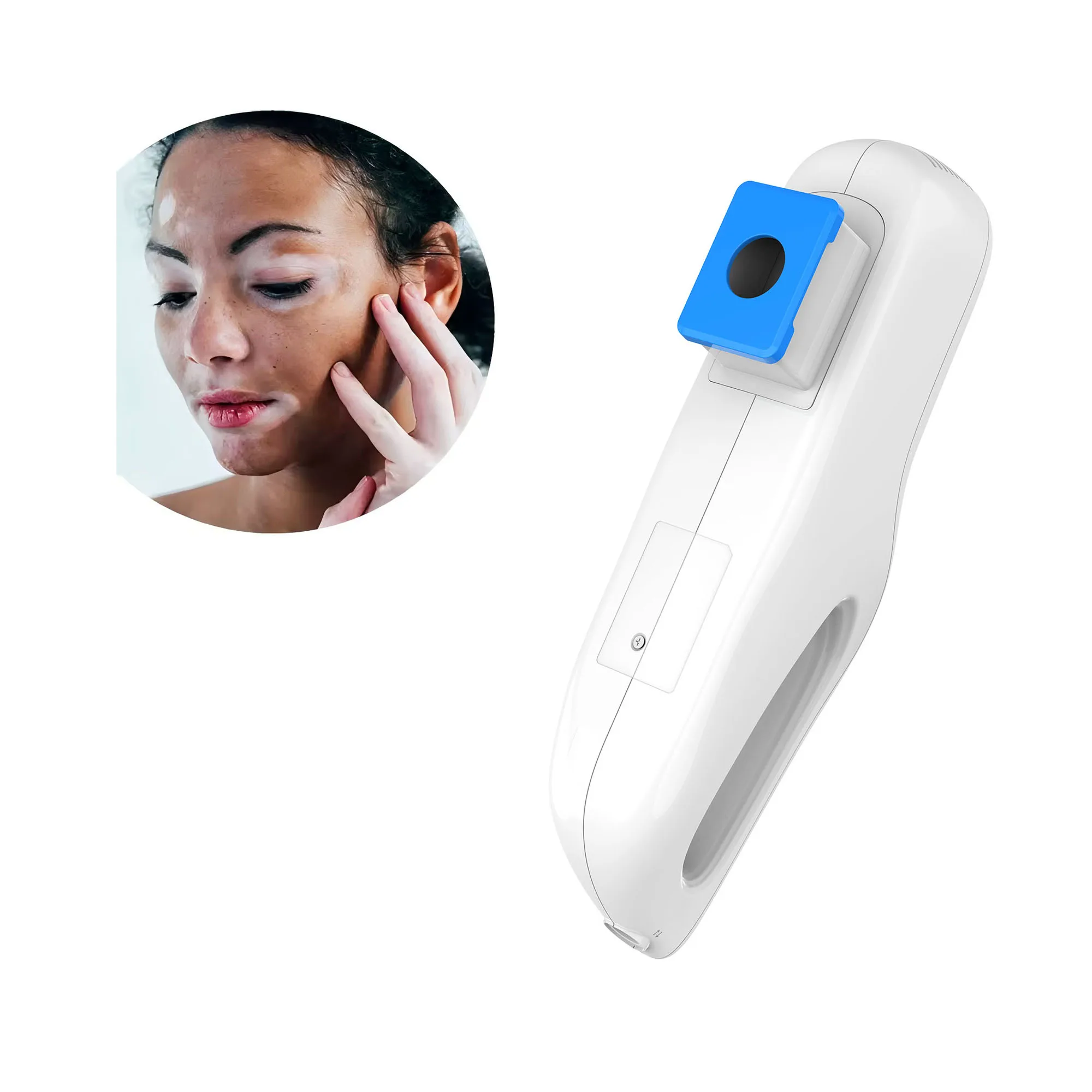 High Quality 5000F Portable Home Use Machine Treatment Laser Excimer Laser Premix Gas 308nm Excimer Laser