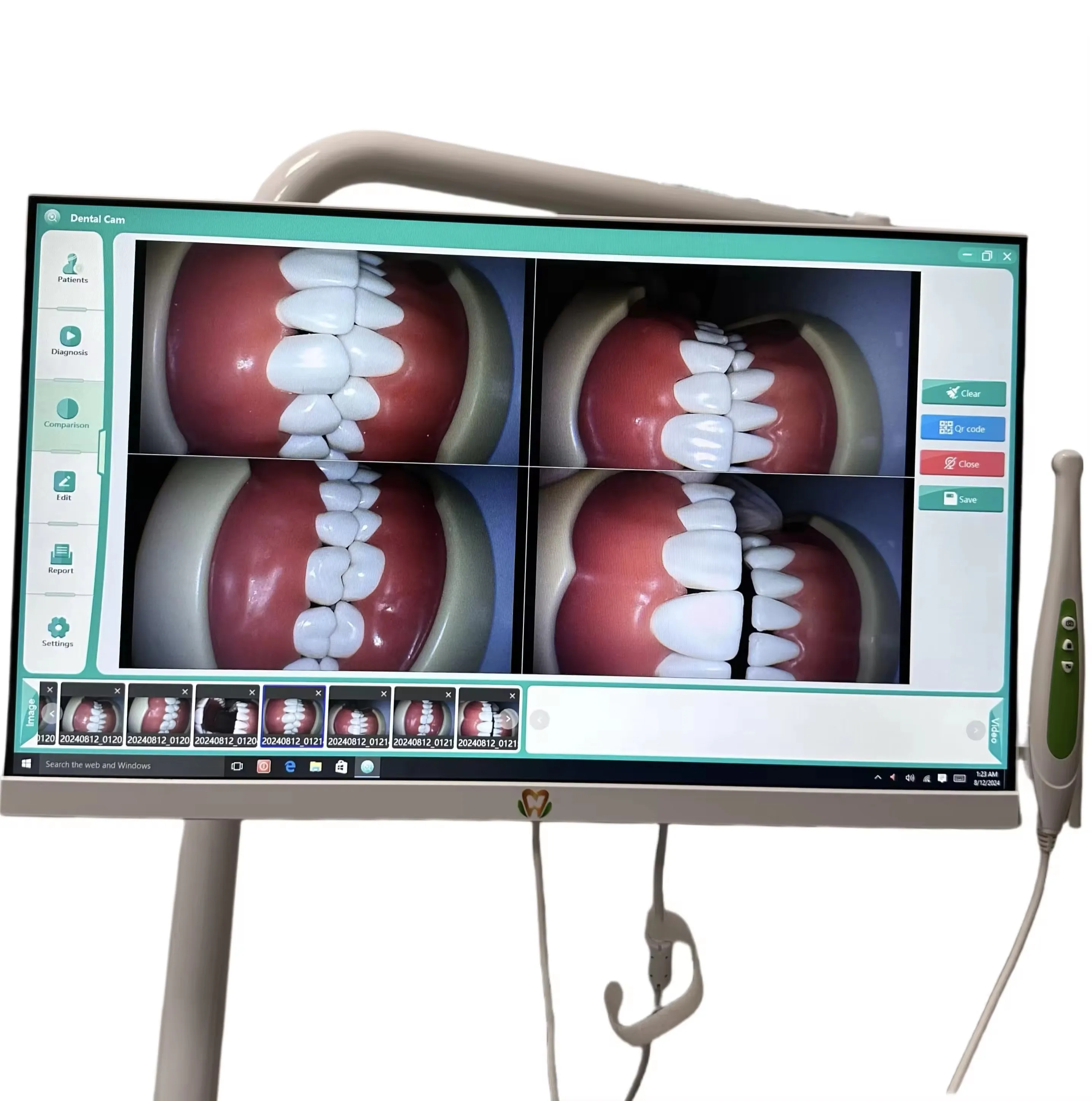 Intergrated Intraoral Camera 24-Inch HD Digital All In One Dental Intraoral Camera WIFI Oral Computer Camera with Bracket Holder