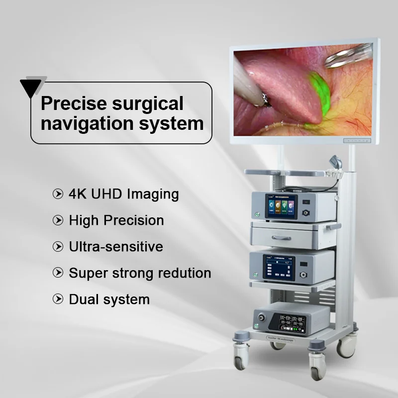 Factory delivery 4K medical Fluorescent rigid endoscopy endoscope camera for Department of urology