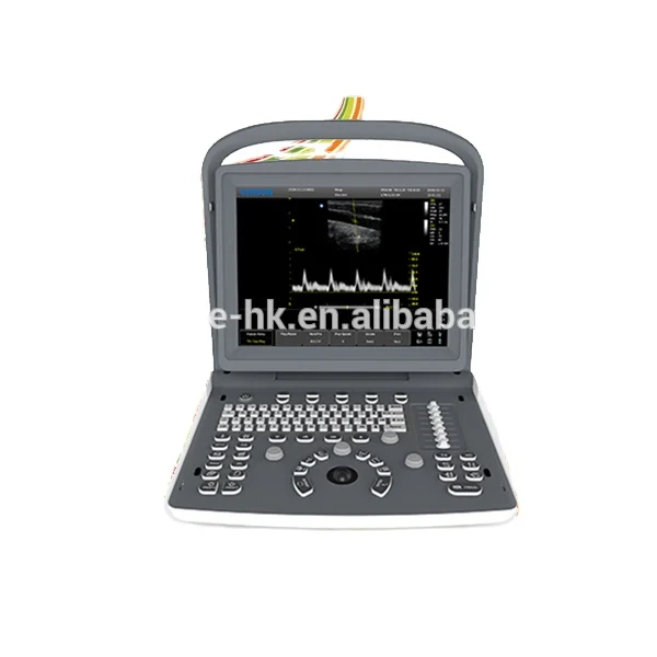 Chison ECO2 Echography Portable Black and White Ultrasound with Doppler Ecografia