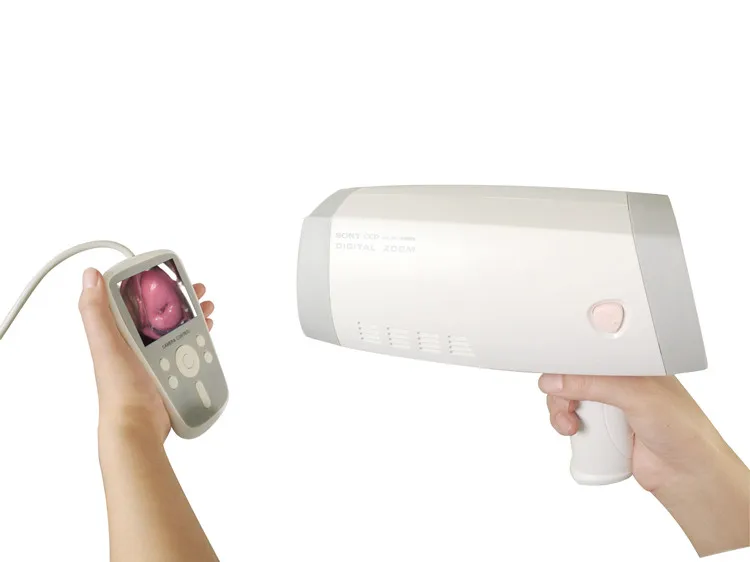 Full HD Colposcope Camera for Vagina Colposcopy