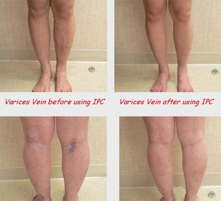 Portable intermittent air pneumatic compression leg foot therapy massager device