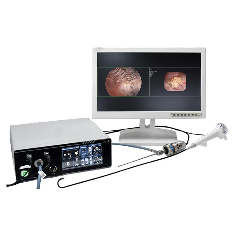 High Definition Endoscopy Camera for Medical Imaging for Gastroscope and Colonoscope Surgery