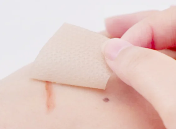 Silicone Gel Adhesive Tape For Scar