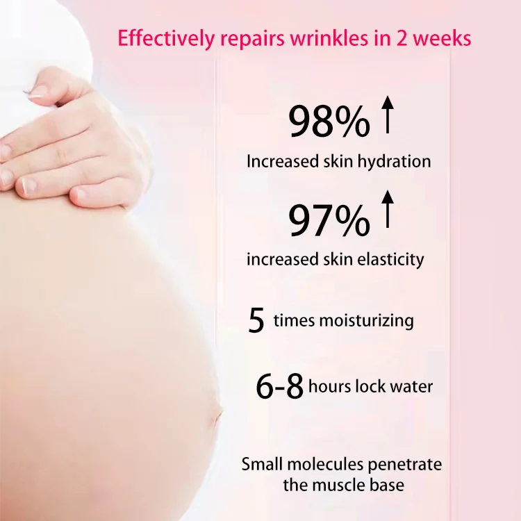 OEM /ODM Private Label Body Skin Care Removal Stretch Mark Skin Vegan Anti Scars Wrinkles Pregnancy Scar Cream
