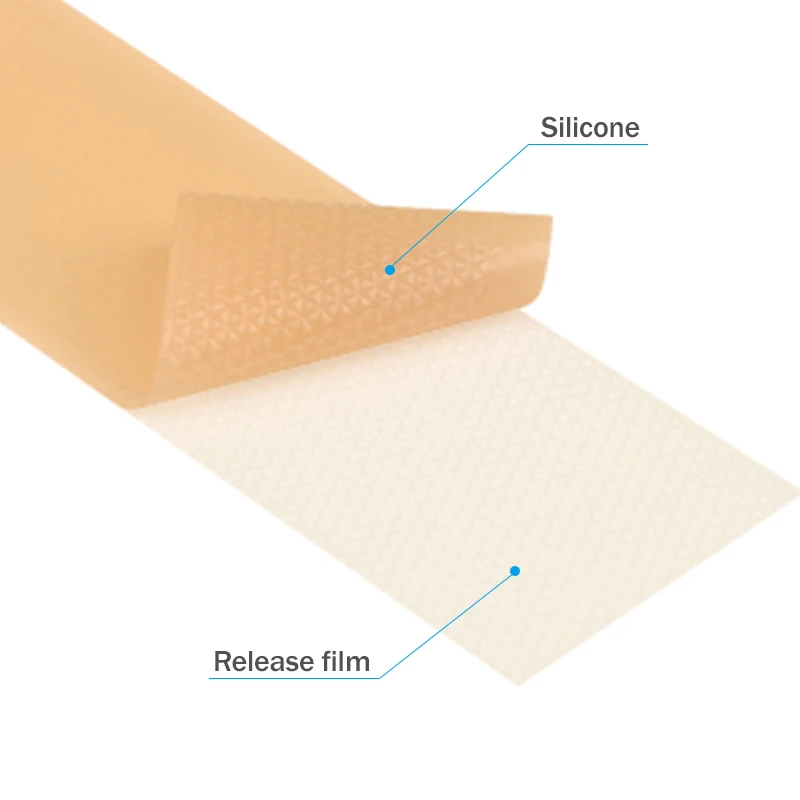 CE ISO BSCI Medical Grade Reusable Scar Away Tape Roll Patch Strips Sticker Remove Scar Silicone Gel Sheet for Striae Gravidarum