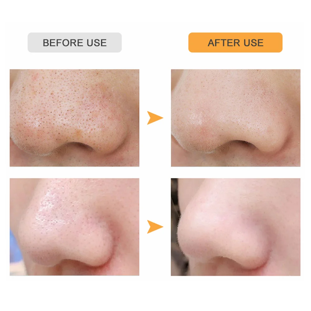 Custom Logo Labels New Design Large Area Pore Nose Deep Cleansing Nose Strip For Blackheads