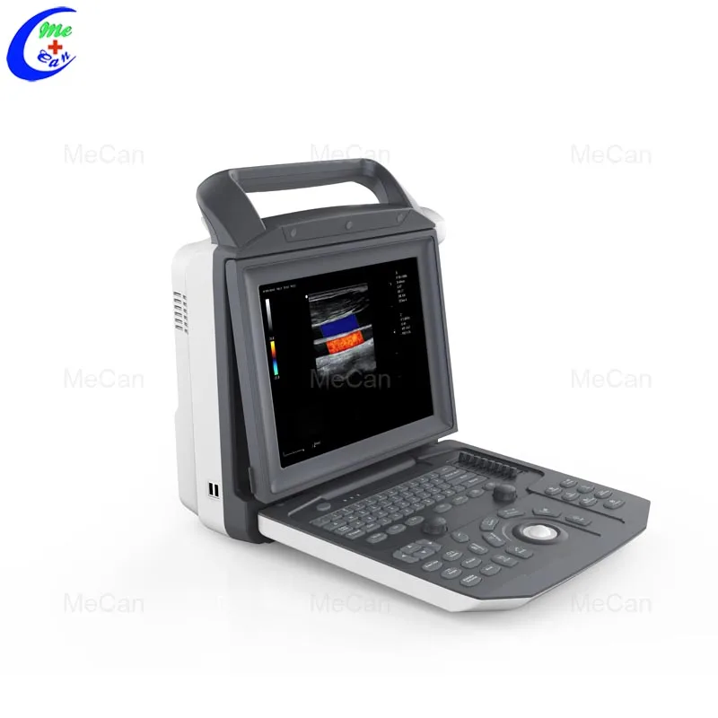 High Quality Portable Best Ultrasound Scanner Machine System 4D Ultrasound Machine With Probes For Clinic