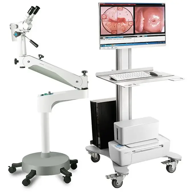 KN-2200B Kernel Bino Medical Optical Video Colposcope Gynecology Colposcopy Camera Colposcope Machine