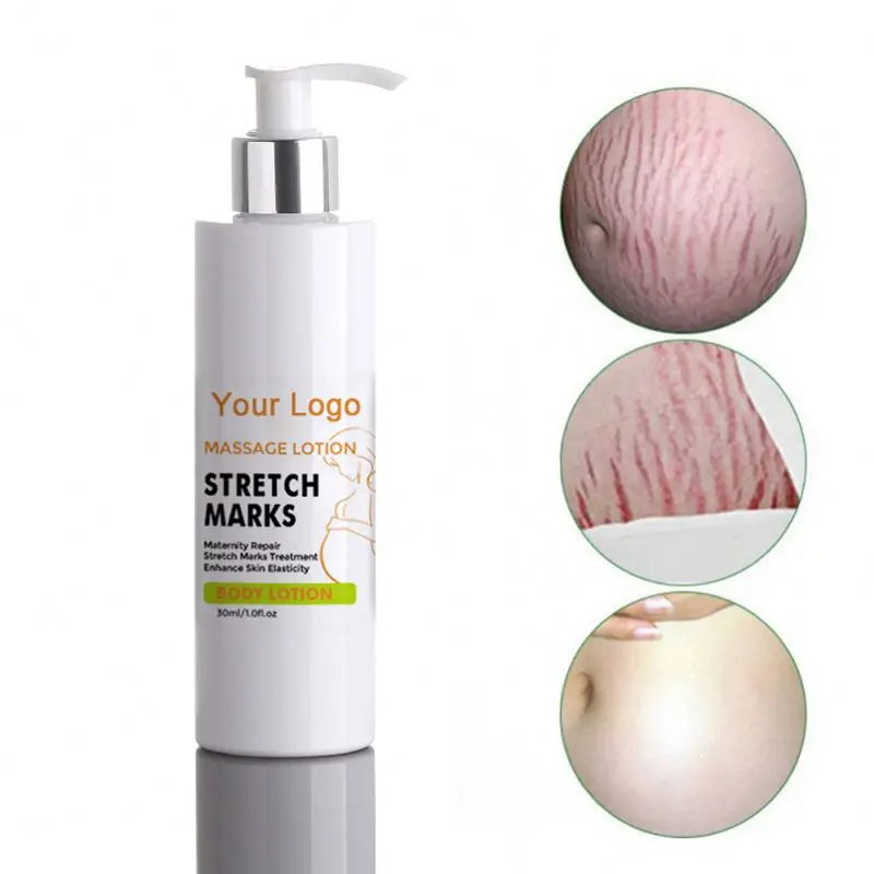 Крем для удаления шрамов от акне, крем для восстановления кожи, Удаления растяжек, лечения акне, уход за кожей