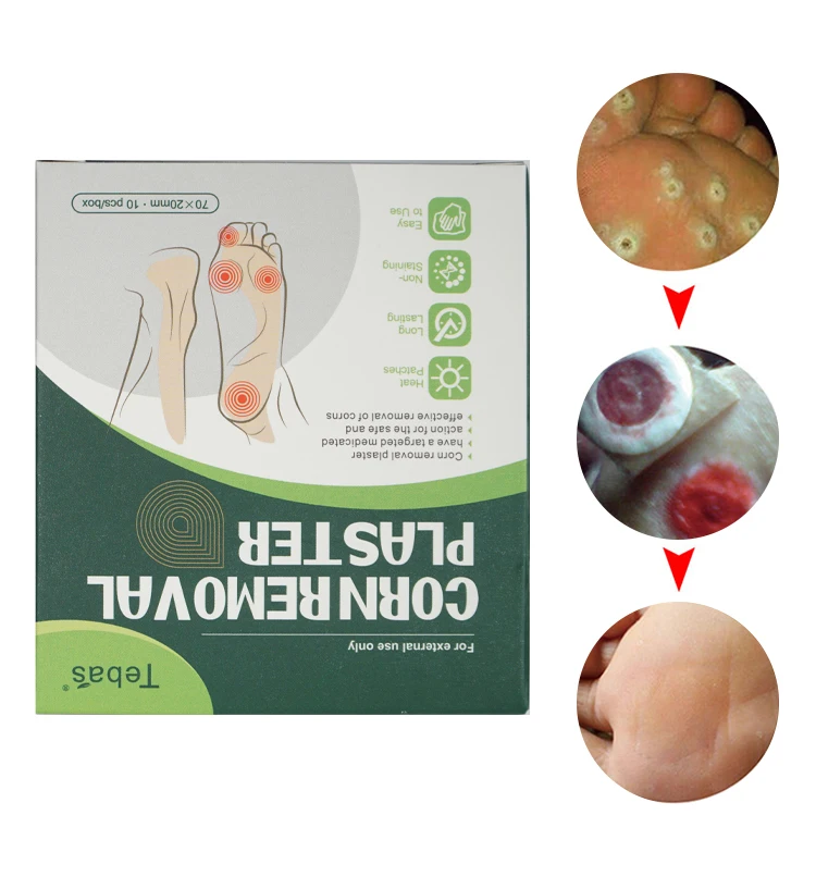 Wholesale private label Disposable Corn Removal Plasters Warts Thorn Remove Corn Foot Patch