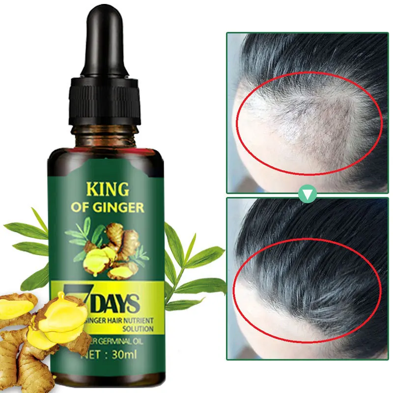 Regrow 7 Day Ginger Germinal Serum Nourishing Scalp Massage Hair Roots Care Essence 30ML 1 Fl Oz Ginger Hair Growth Germinal Oil