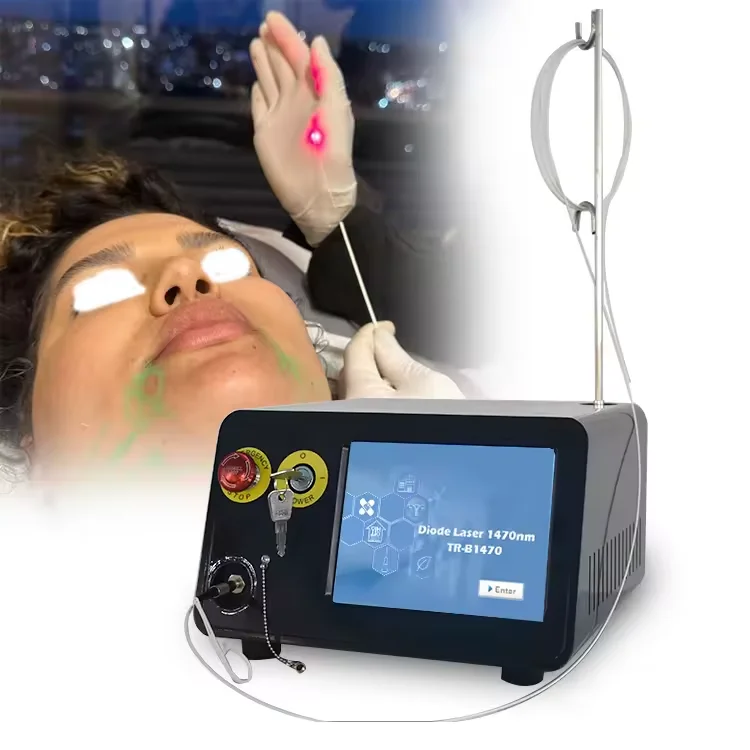 Endolaser 1470nm Face Lifting Skin Rejuvenation Fiberlift Laser Liposuction Machine